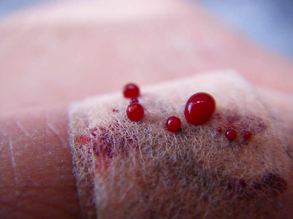 Blood
