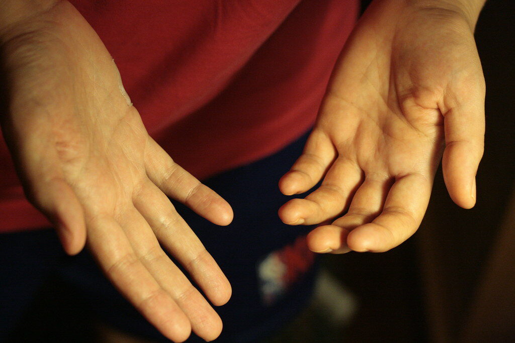 Hands