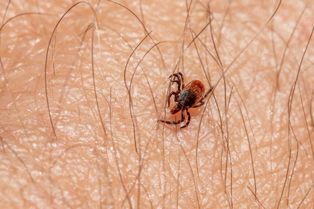 a close up of a spider on a human's skin